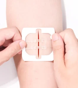 Transparent Skin Wound Closure Device Steri Strip Tape Stitches Bandages Dressing MDT PWT1003 Far Infrared CE Certified Medical