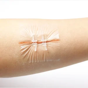Transparent Waterproof Bacteria Resistant Zipper Band Aid Painless Wound Closure Device Medical Grade Suture Needles Wound Band