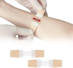 Transparent Wound Dressings Wound Closure Strip Skin Closure Butterfly Bandages