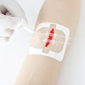 Transparent Zip Stitch Dressing Adhesive Bandage 6x7cm Sterile Strips Wound Closures