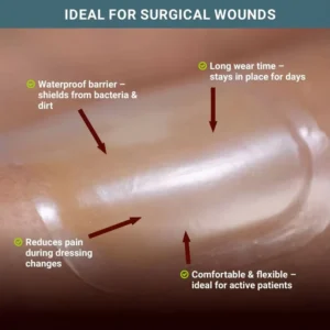 Ultra Thin Bordered Hydrocolloid Dressing Made of Pressure Sensitive Adhesive with CMC Hydrophilic Granules for Wounds