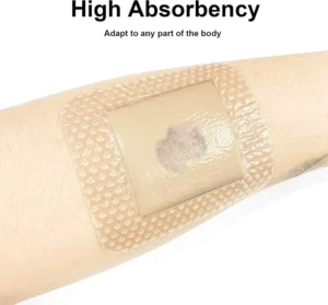 Wound Care Foam Dressing Self Adhesive Wound Dressings Super Absorbent Silicone Foam Dressing