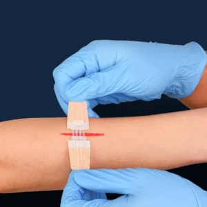 Wound Closure Dressing Surgical Wound Strip Wound Closure Device Wound Closure Strip