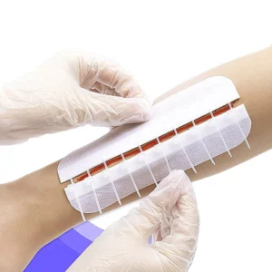 Wound Device Zip Wound Closure Wound Splice Closure