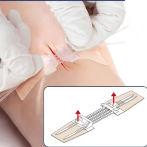 Wound Skin Closure Zipper Bandage Transparent Wound Dressings Steri Strips