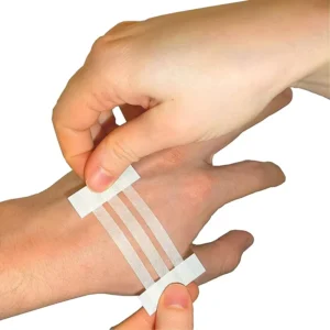 Wound Skin Suture free Device Closure Strips Closure Suture Tape Medical Pull together Tape for Small Wound Recovery