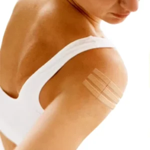 Wound Sterile Wound Dressing Wound Skin Closure Strip