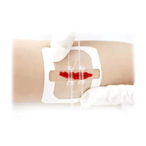 YOJO CE ISO EO Disinfecting Zip Reinforced Topical Skin Wound Steri Strip Tape Adhesive Strips Surgical Skin Closure
